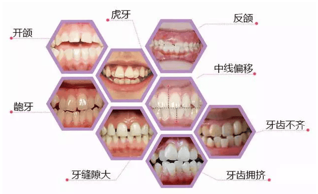 日本牙突剑术图片