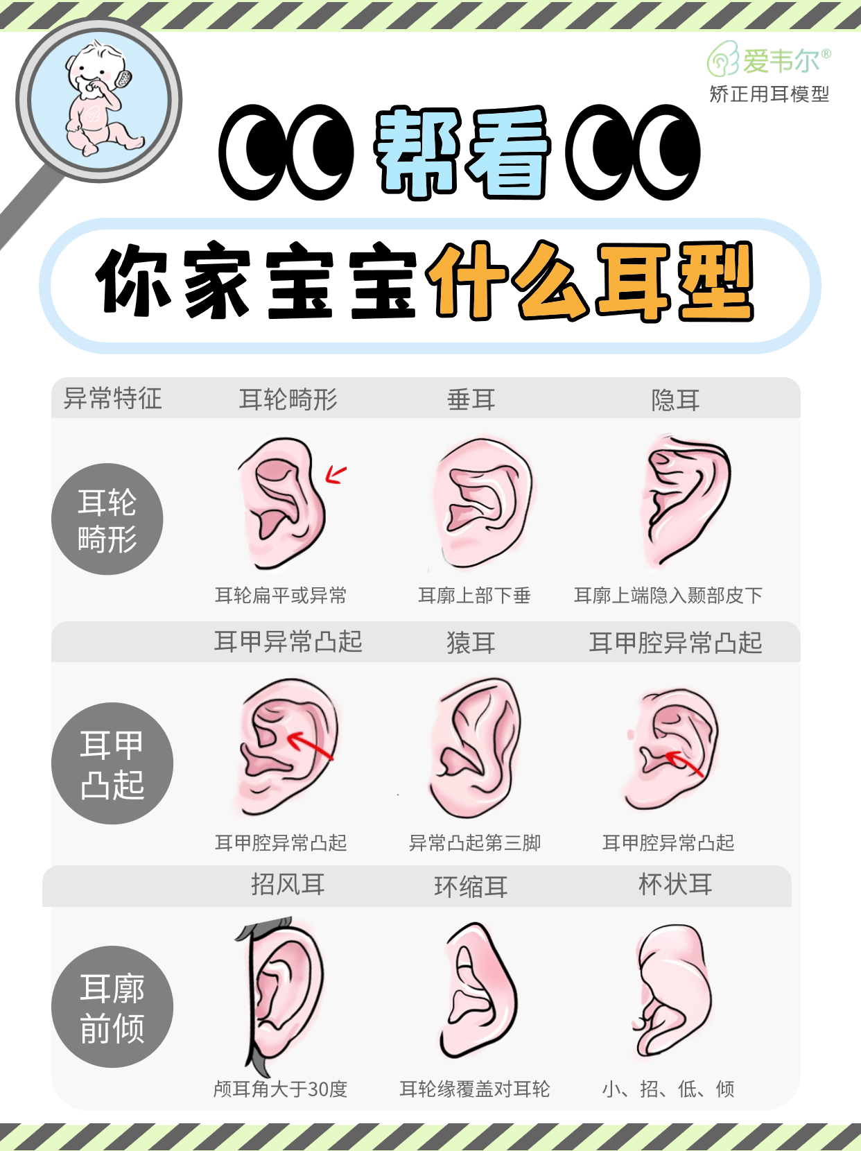 耳朵型分类图片大全图片