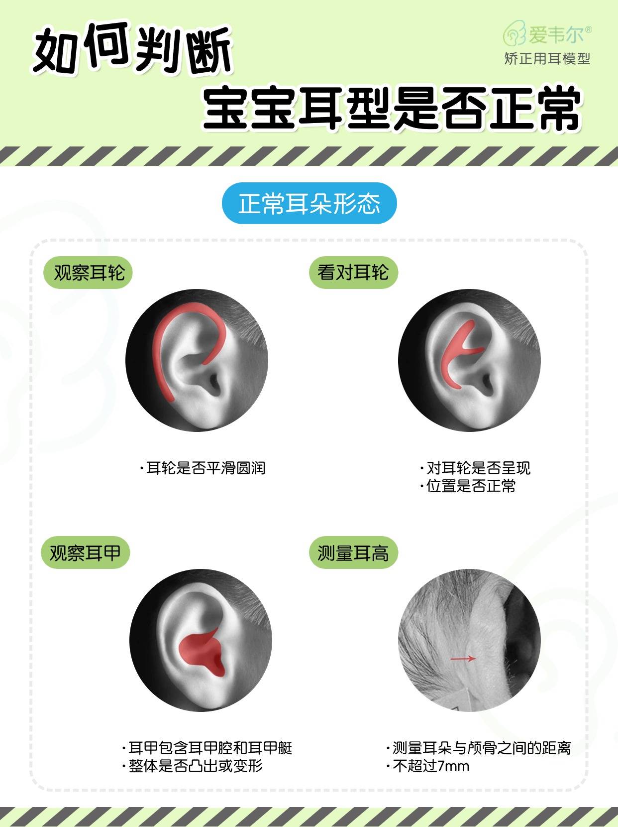 如何判断宝宝耳型是否正常?