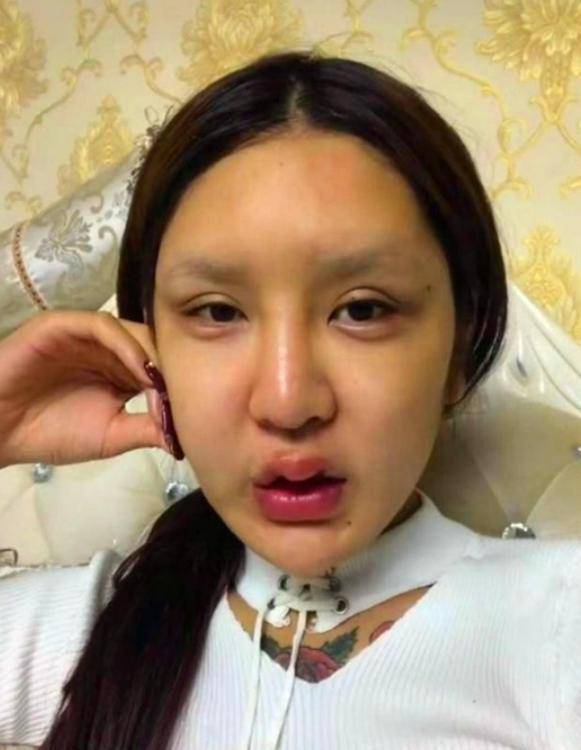 "花费近百万",三年动了60次的网红女孩现在咋样?简直判若两人