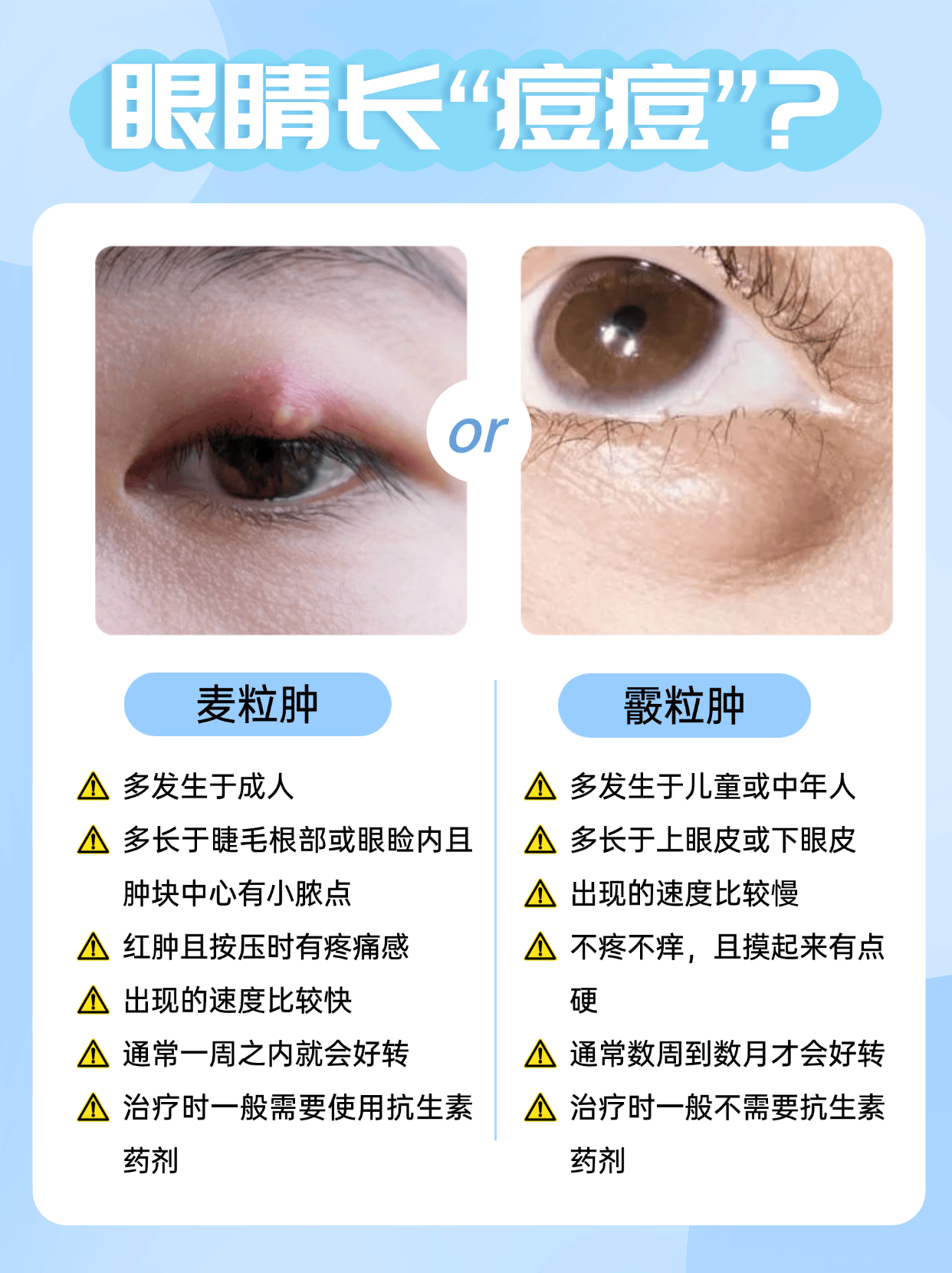 霰粒肿怎么消除方法图片