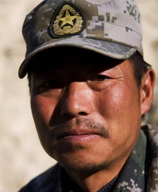 英雄团长祁发宝近况:身体恢复良好,头颅伤痕依旧明显