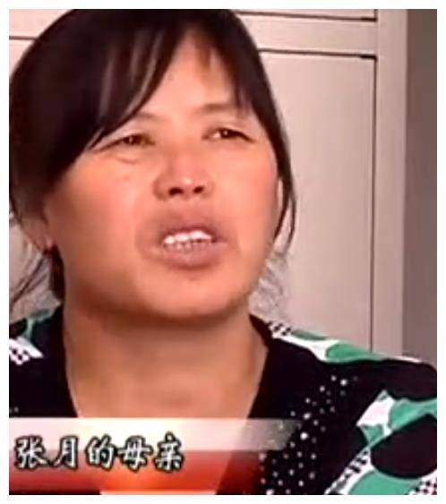2009年男子被烧成"焦炭",医生为救人,将10万条蛆虫放在他身上