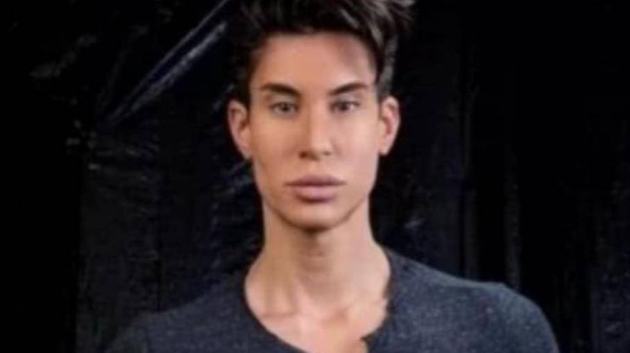 2013年,美国男子整容190次变芭比男友,曾花154万在后背植入翅膀