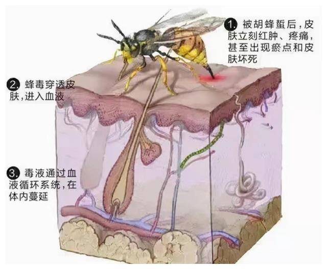 被蜜蜂蛰死图片