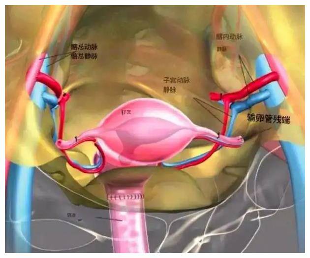 变性手术下面子宫图片