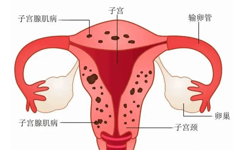 9岁儿童卵巢子宫发育图片