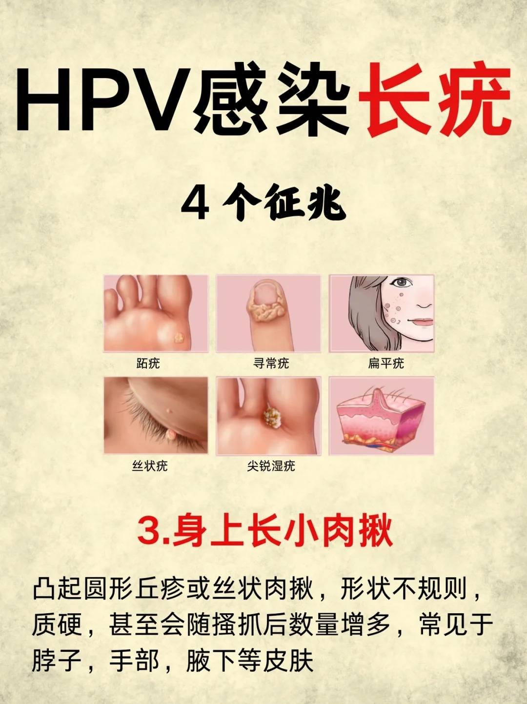 榜单揭晓-无锡哪家医院能治hpv