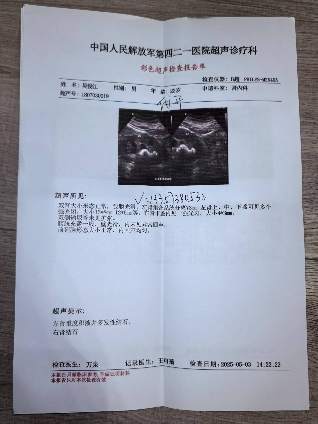 如何制造假月经血=什么可以冒充月经血
