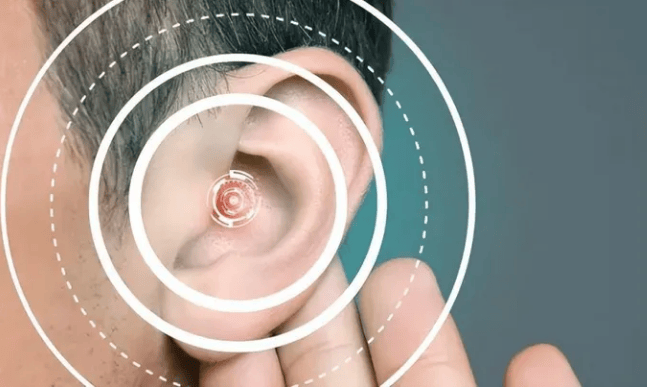 开放式耳机怎么样?值得买吗?开放式耳机最佳推荐首页