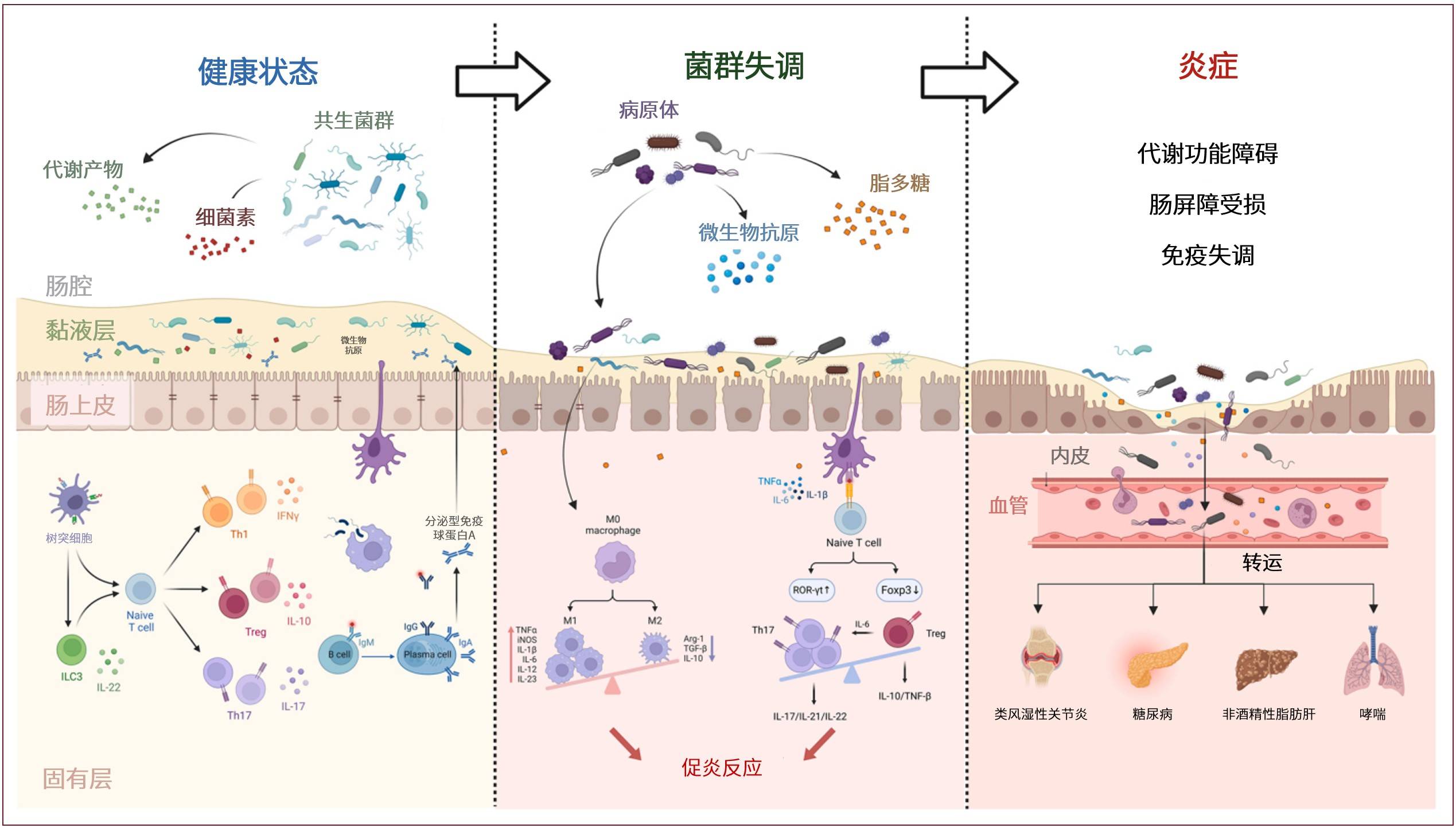 肠道菌群诱发炎症性疾病的机制