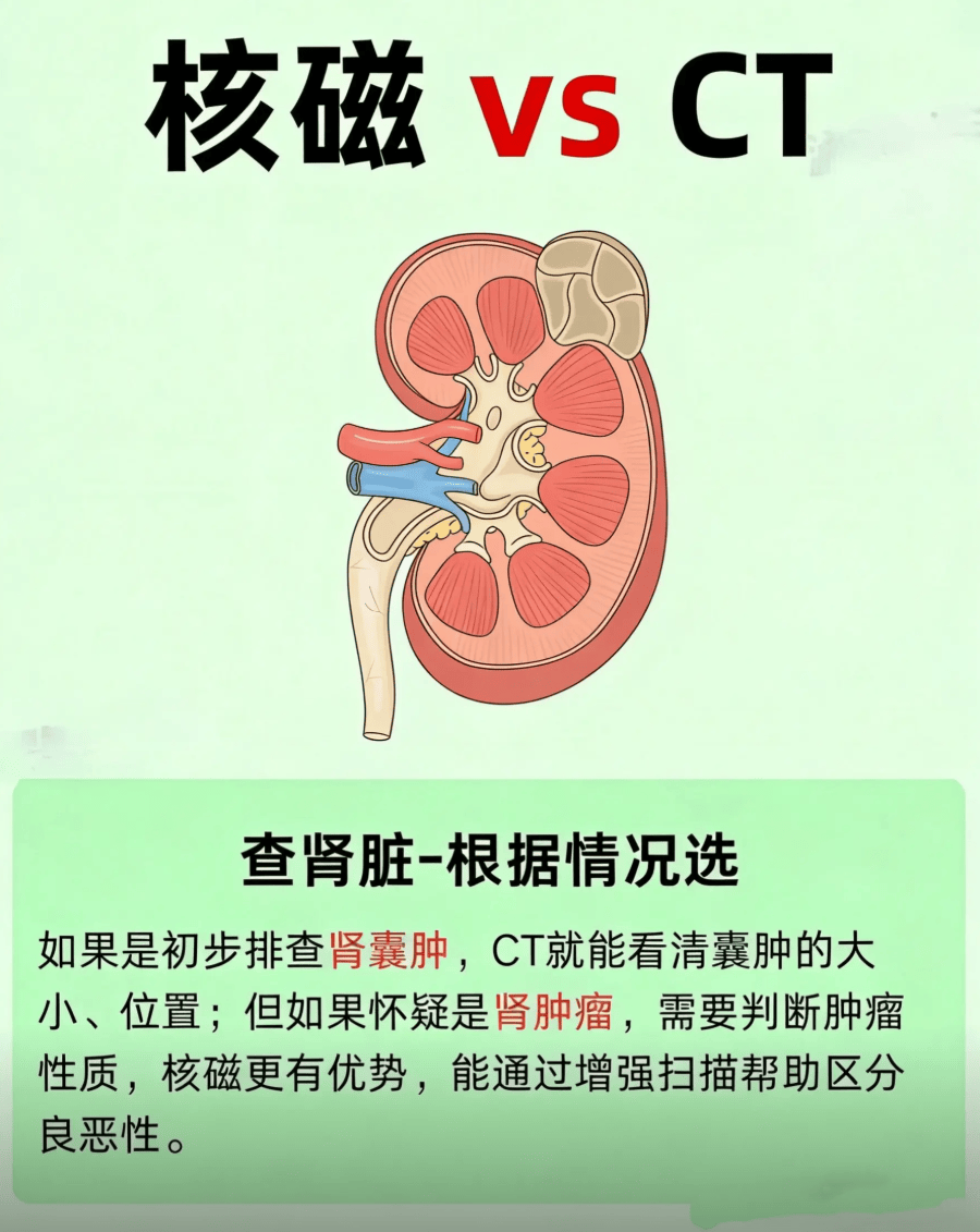 肾脏核磁.png