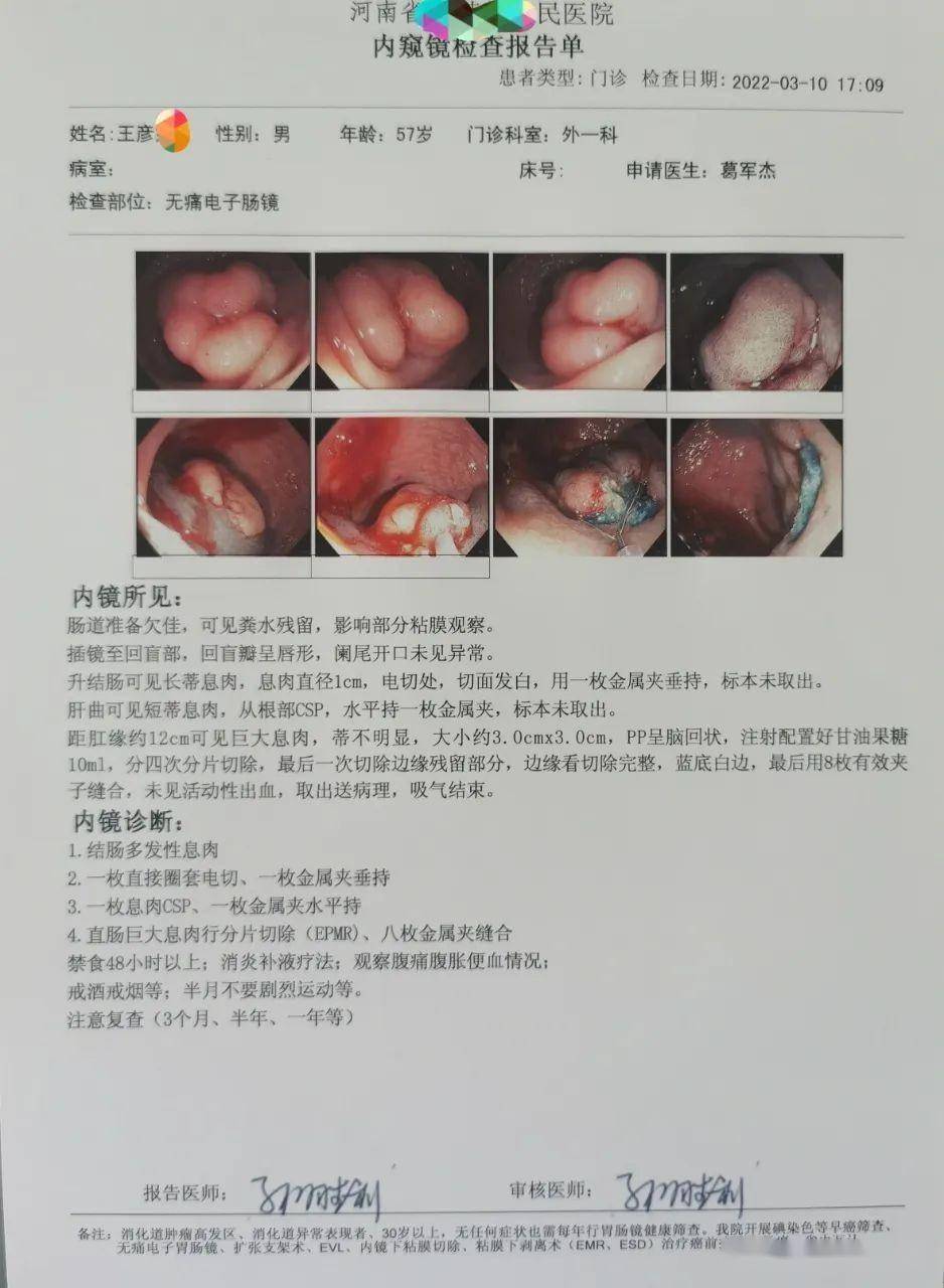 肠镜正常结果图片图片