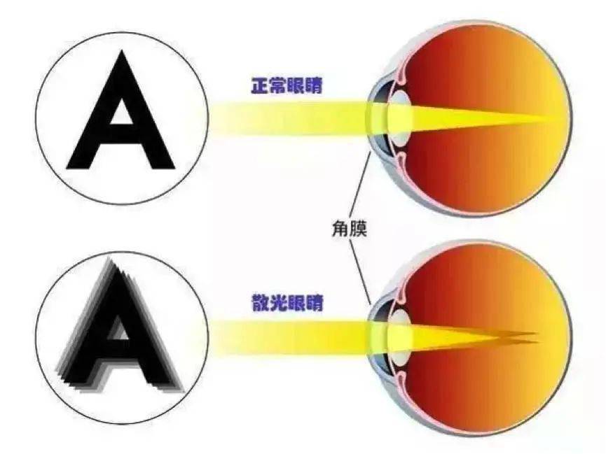 重影竟然还分单眼和双眼?_影像_东西_眼睛
