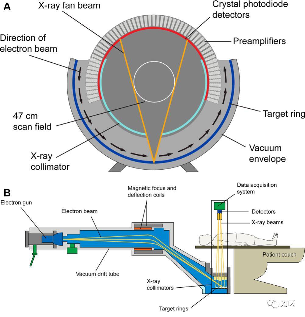 該系統也稱為電子束ct,電子槍發射的電子束通過磁力快速掃過患者周圍