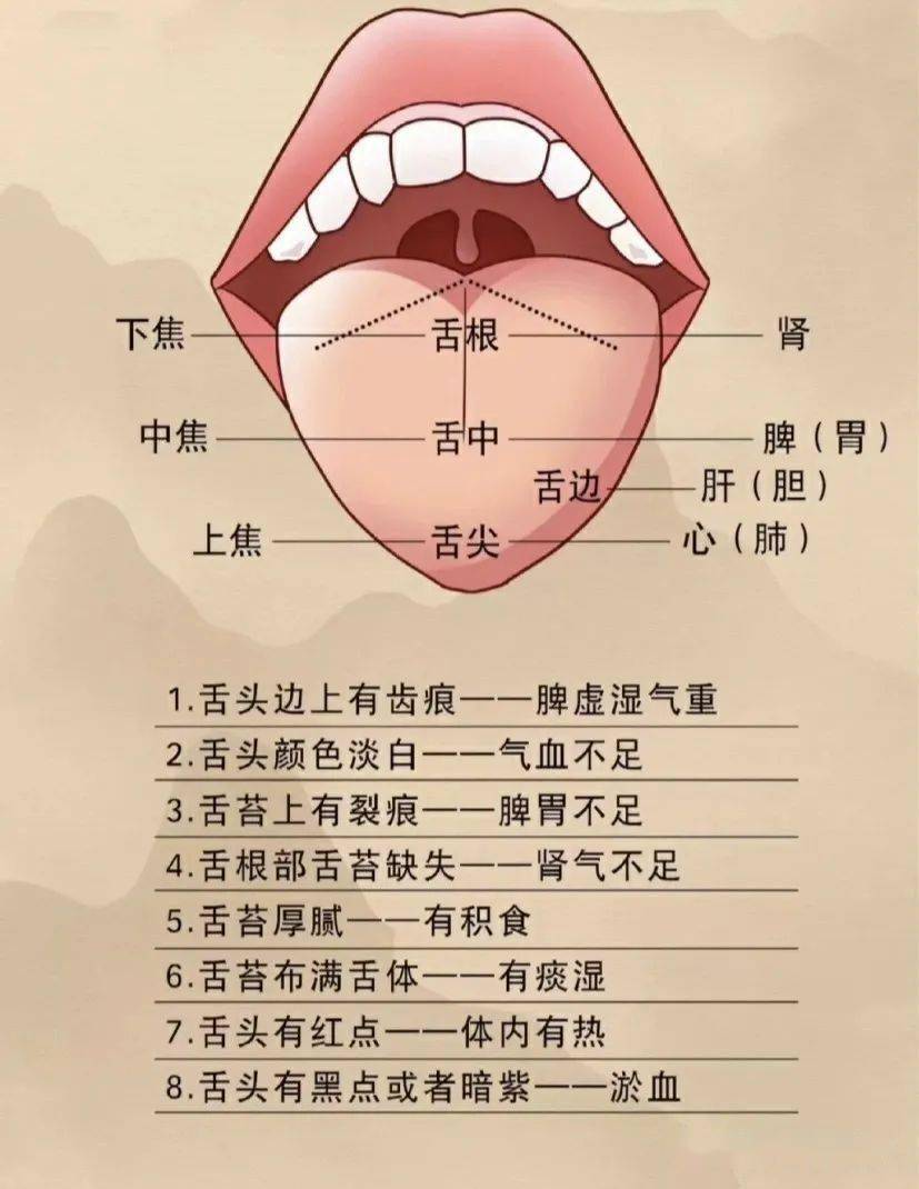 一张图带你看懂舌苔,7种常见舌像看看你是什么体质_舌头_身体_疾病