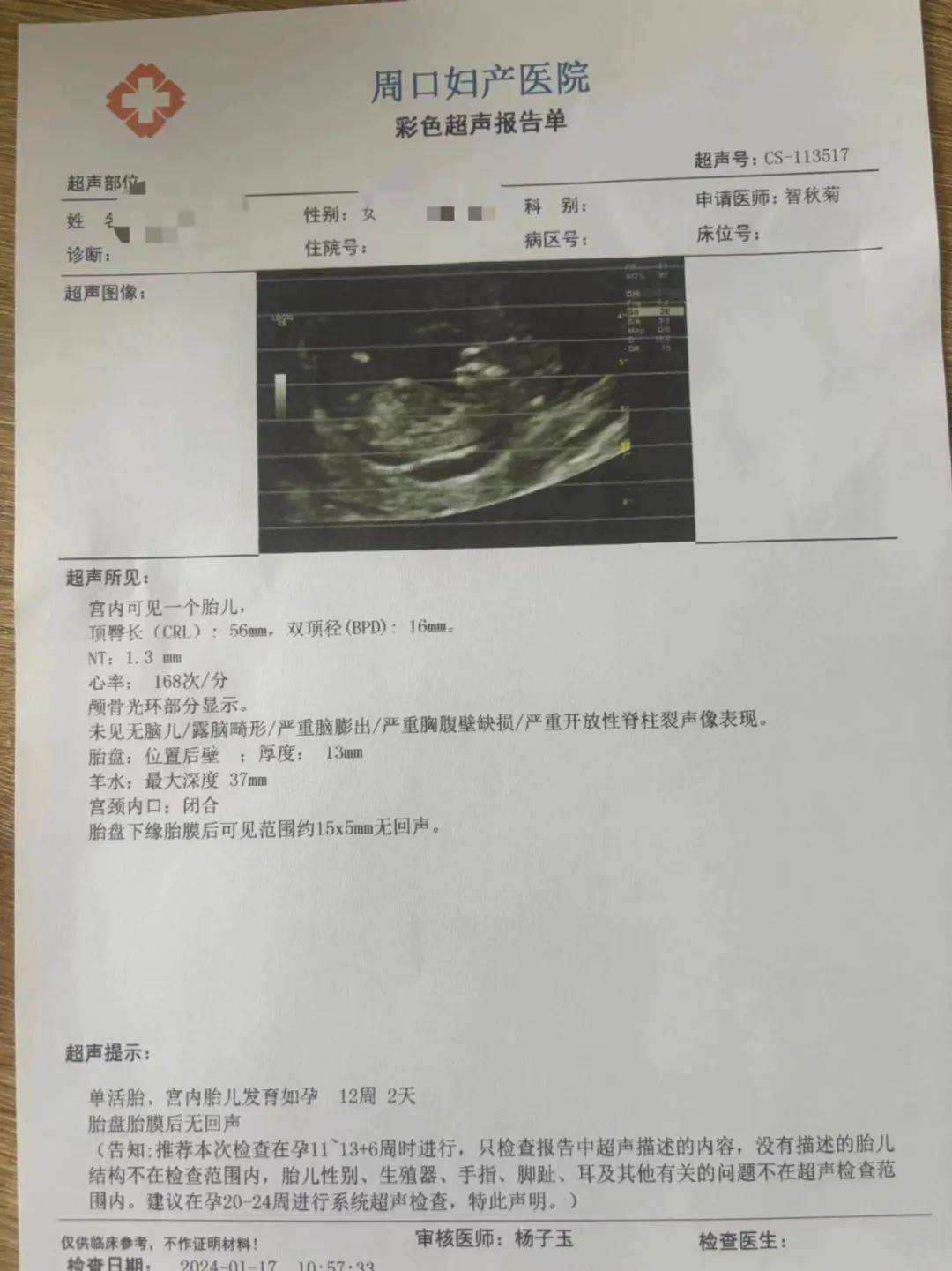 子宫囊肿检查报告图片图片
