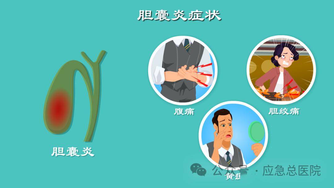 急性胆囊炎 来自搜狐网