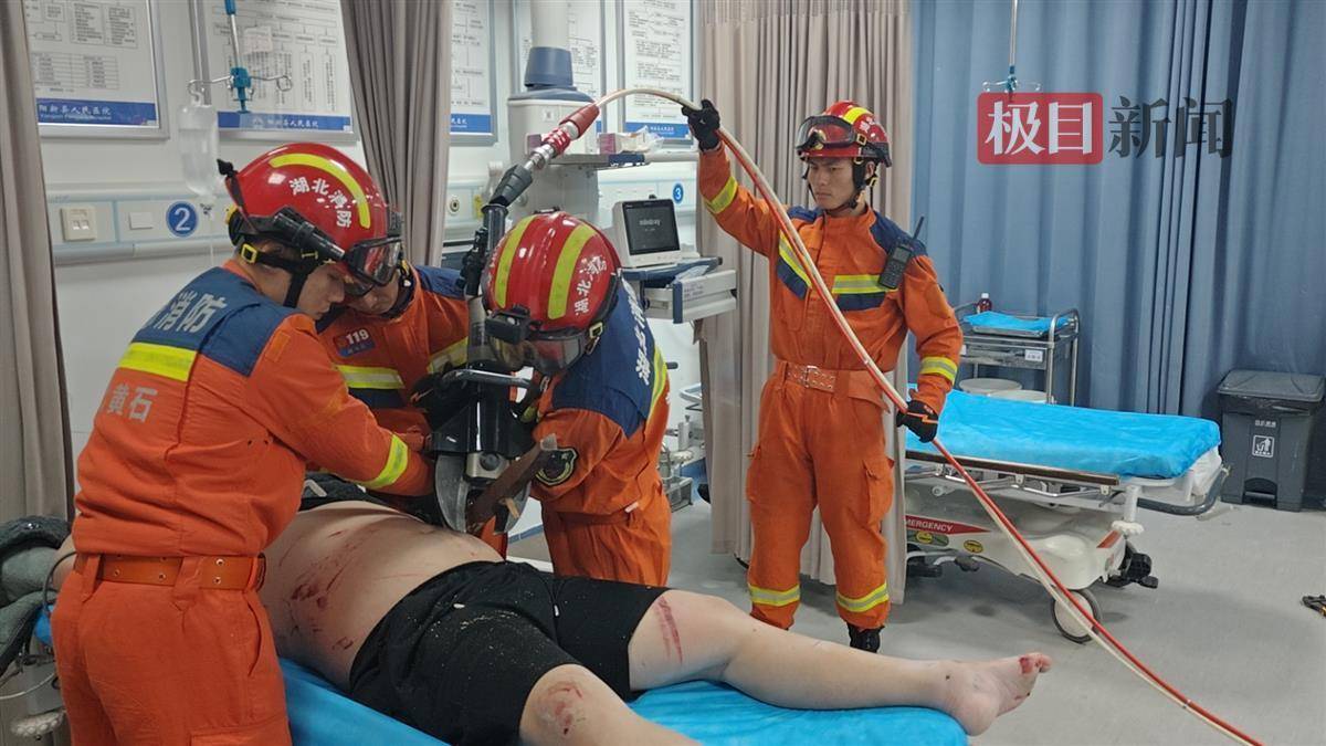 胸部,医生经过55分钟的手术,成功将凳腿取出,并为柯某进行了清创缝合