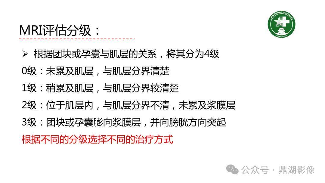 剖宮產術後子宮瘢痕妊娠的mri診斷_影像_全網_解剖圖