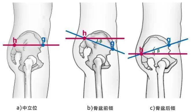 標誌點選取:選取股骨大轉子點作為標誌點.標