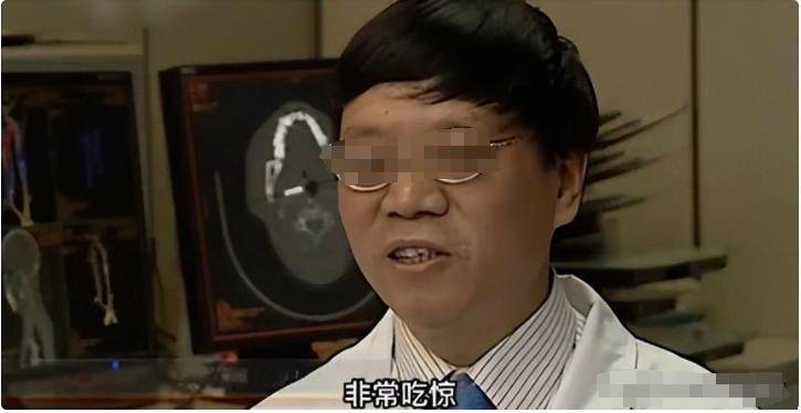 雲南男子被妻子按摩到吐血,去醫院檢查,醫生:你腦袋裡