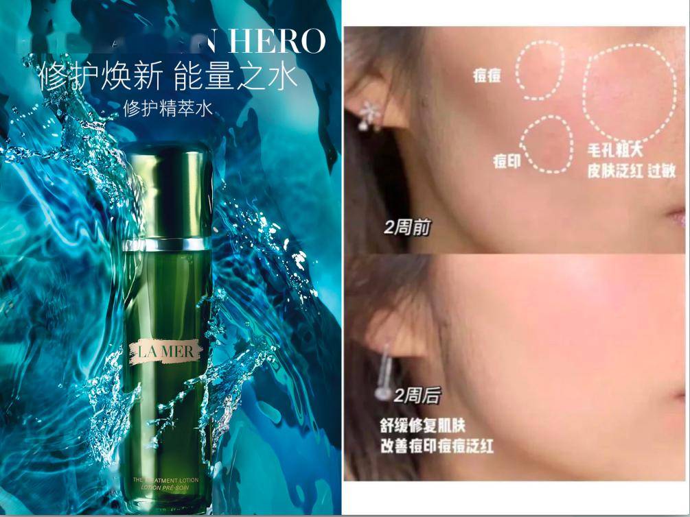 而现在,肌肤很难维持好的状态,痘痘肌,敏感肌,红血