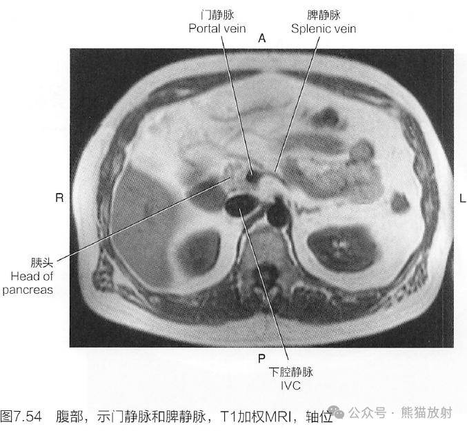 第一肝门横断面图片