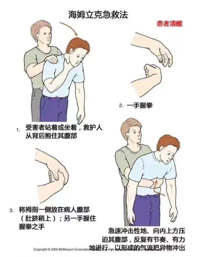 元宵节将至吃汤圆,老年人要警惕"软糯"隐患_患者_食物_气管