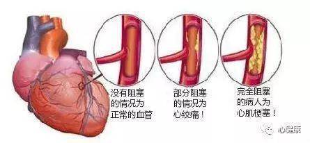 以避免延误