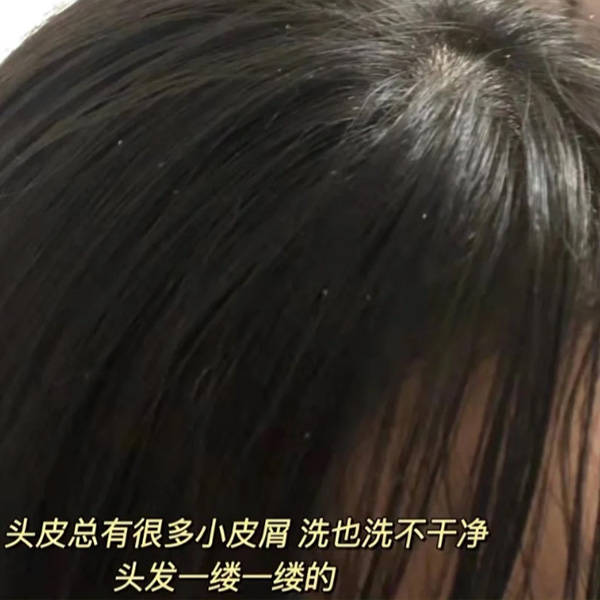 1:花 诉 妍专研去屑净爽洗发乳最近头上莫名其妙地冒出了一片片令人