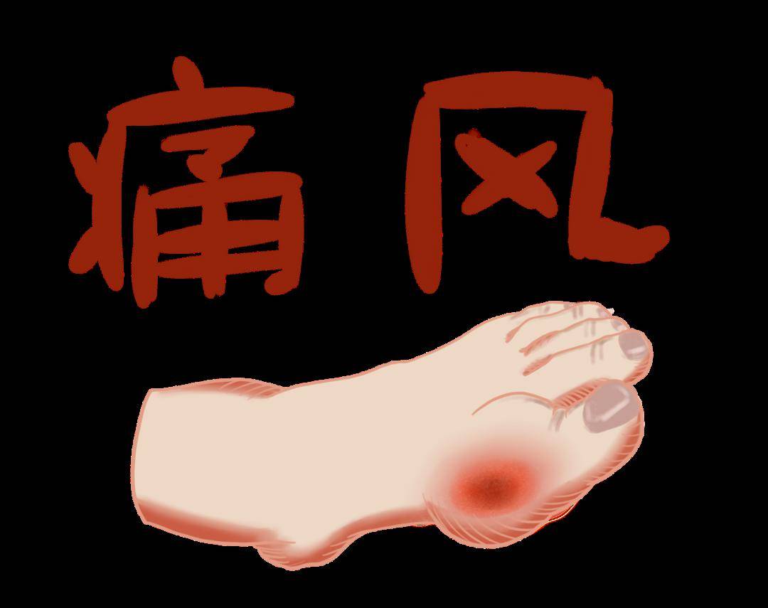 春节后,痛风高发,了解这些知识远离它_尿酸_关节_患者