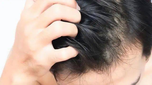 洗完头发就容易出油变软塌?