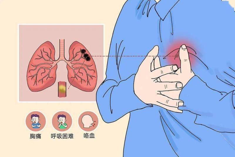 空气栓塞心脏图片图片