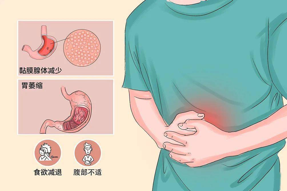 科学就医我行动 带您了解慢性萎缩性胃炎