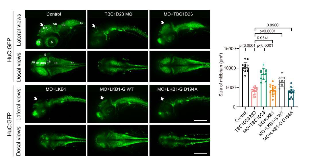 我院贾大团队揭示单基因脑桥小脑发育不全症的发病机制_高尔基体_研究