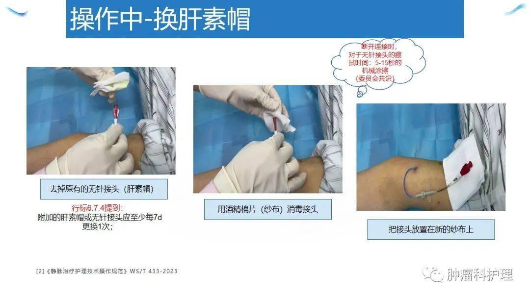 【ppt】经外周静脉置入中心静脉导管(picc)的规范化维护_护理_相关