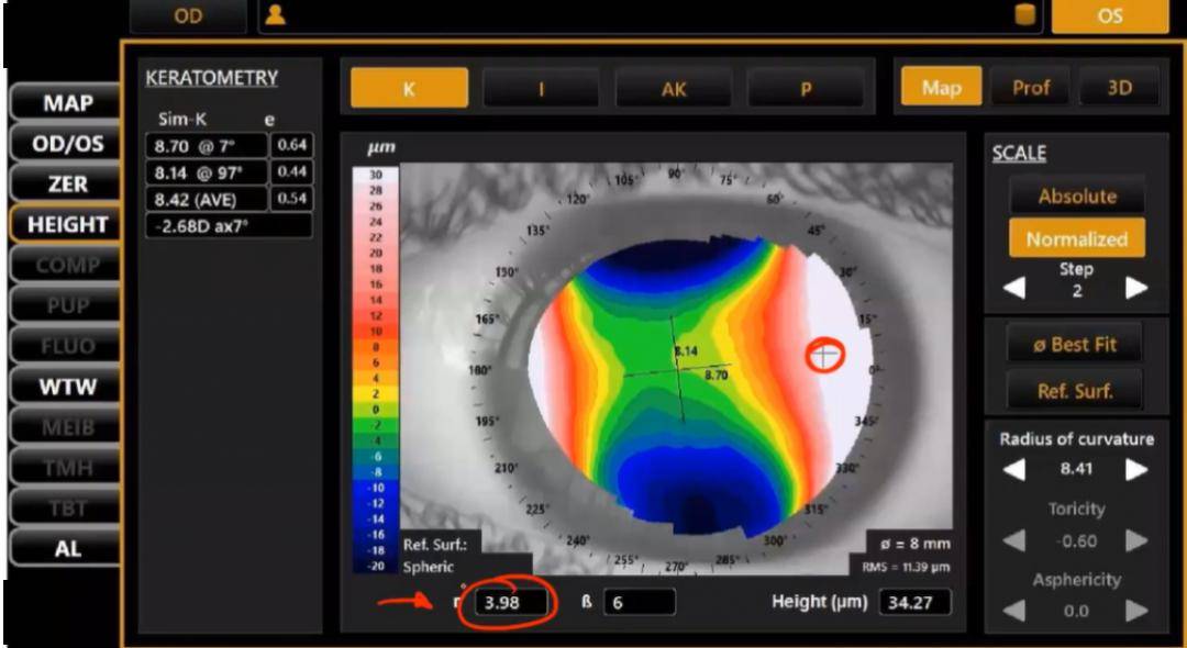 索维角膜地形图SW-6000图片