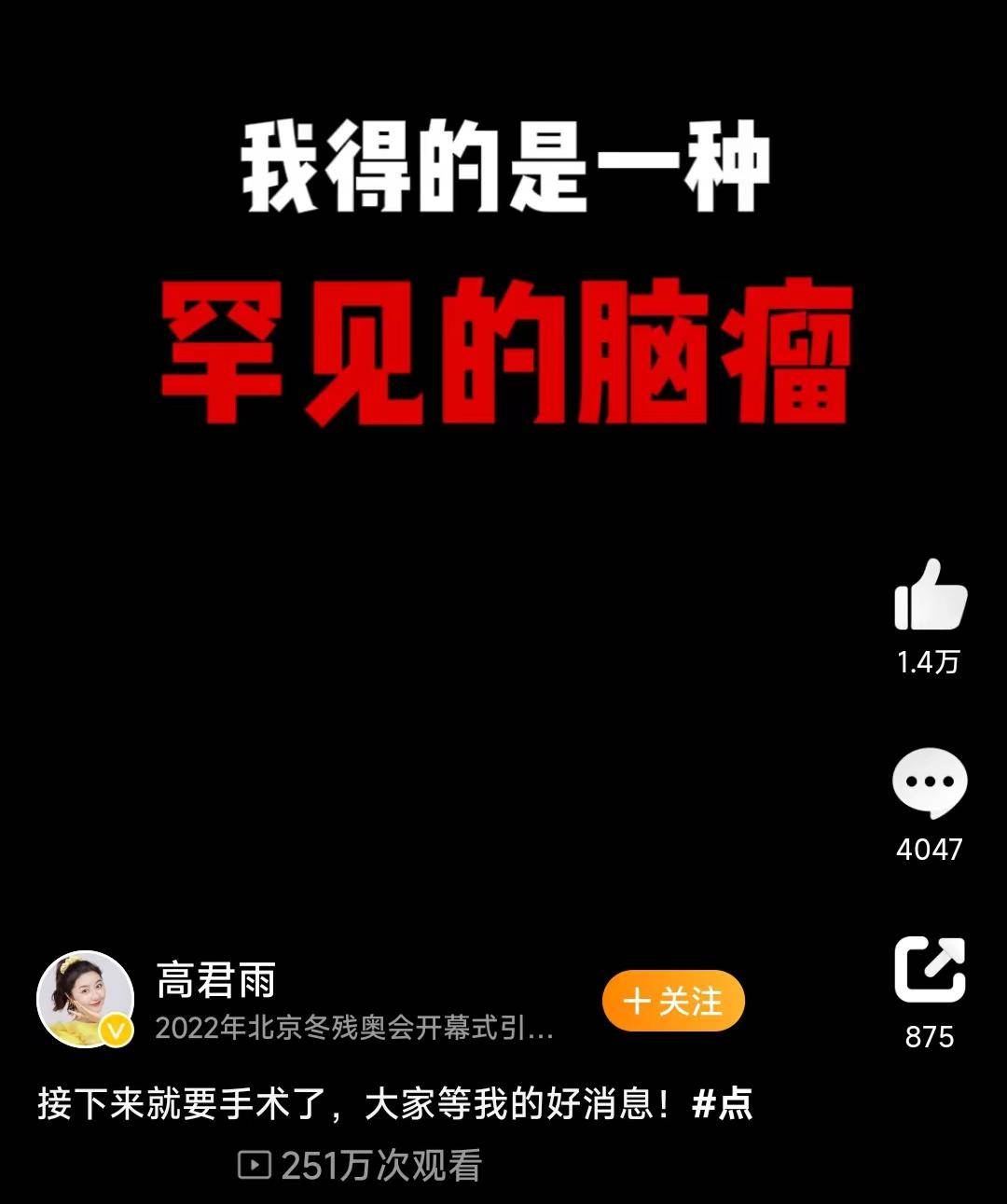 她手术成功_高君雨_视频_网友