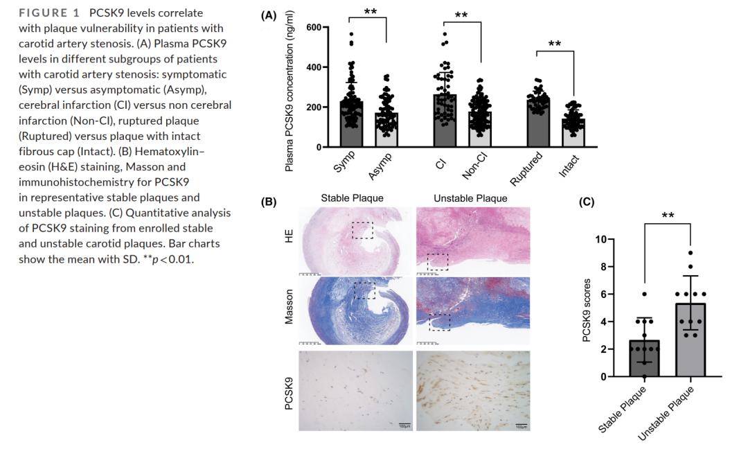 与完整纤维帽cas患者相比,伴斑块破裂cas患者的pcsk9表达显著增加(p 