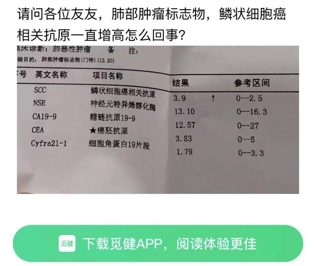 鳞状细胞癌抗原1.6图片