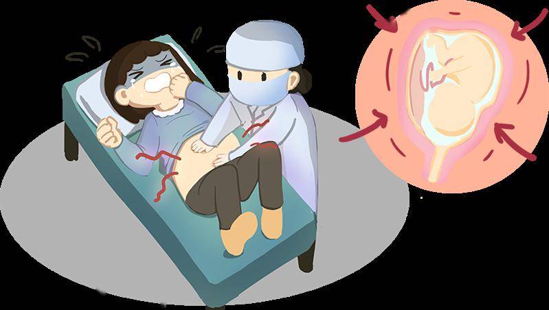 生死营救阳新县妇幼保健院成功抢救胎盘早剥孕妇