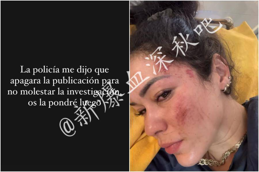 西班牙重机网红游印度惨遭7男轮奸老公全身伤泪曝遭遇