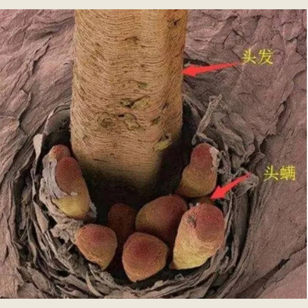 头发去屑止痒用什么洗发水好