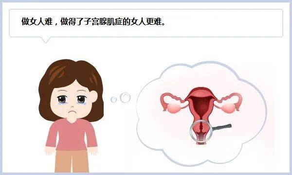曼月乐脱落风险高咱来给它缝到子宫壁上