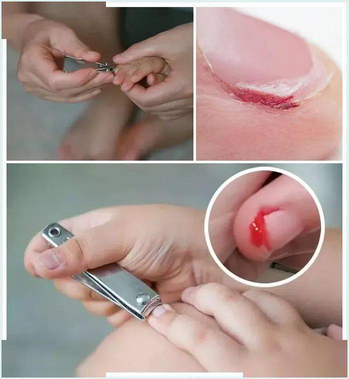 阳江指甲钳49元4件装比宝马更耐造比切割机锋利能亮甲修倒刺