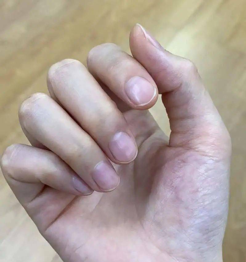 能亮甲修倒刺!_修剪_传统_手指