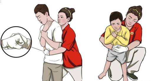 这个拥抱能救命人人必学的海姆立克急救法