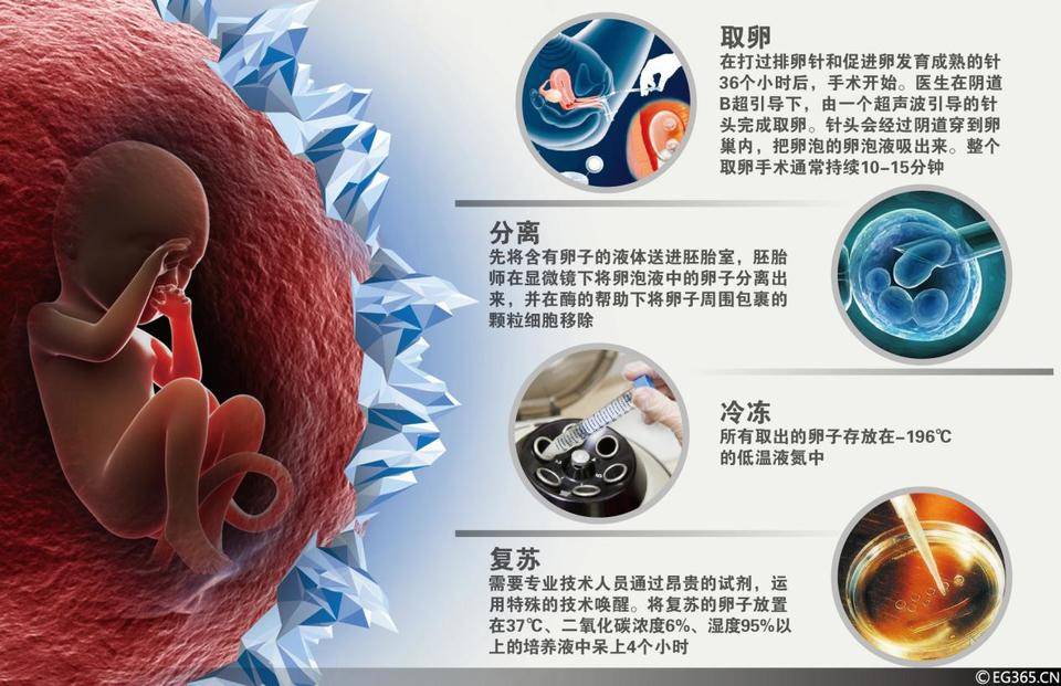 冷冻一个卵子需要几步?专家介绍,这涉及取卵,冷冻,储存几个环节.