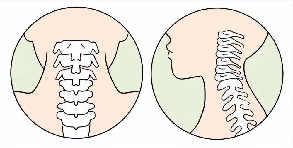 科普大讲堂颈椎间盘为何你如此突出